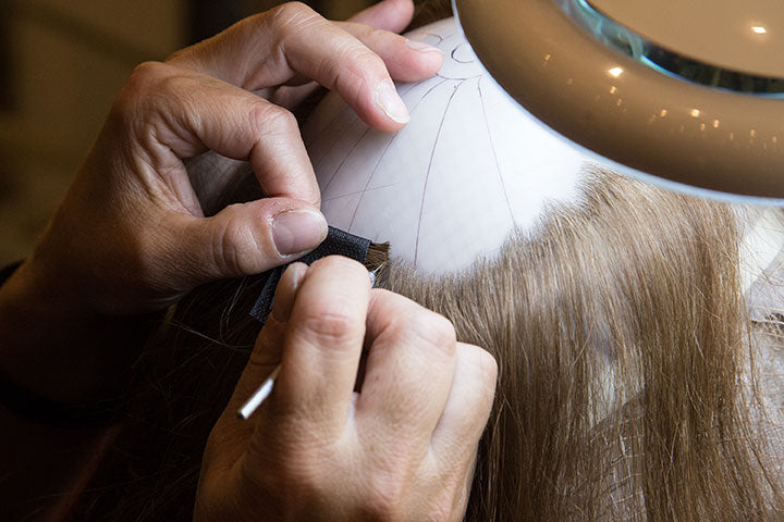 custom non surgical hair replacement solution Utah